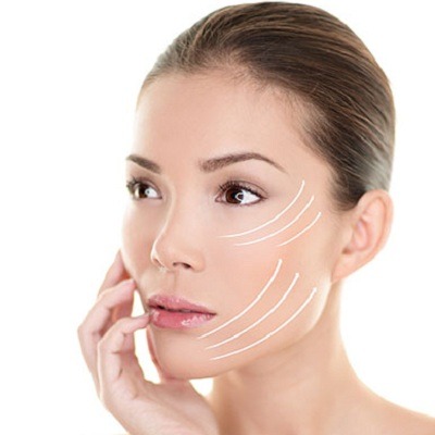 Best-PDO-Thread-Lifting-Clinic-In-Islamabad-Pakistan-PDO-Cost