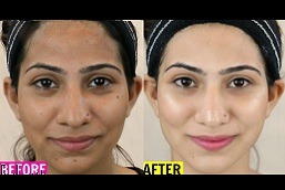 Best skin whitening Clinic in Islamabad