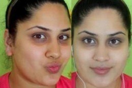 skin whitening Clinic in Rawalpindi