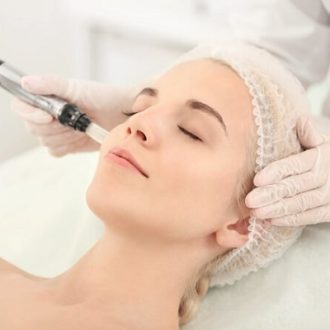 Microneedling Treatment Cost in Islamabad