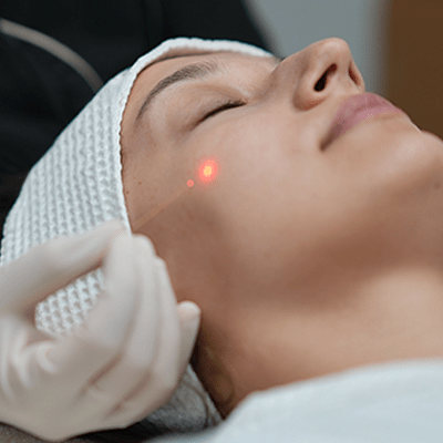 Endolift in Islamabad, Rawalpindi & Pakistan Medixo Clinic