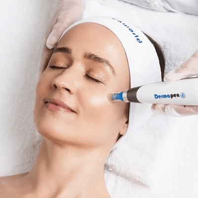Dermapen Treatment in Islamabad, Rawalpindi & Pakistan Cost & Deals
