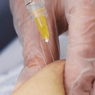 Price of Lemon Bottle Injection Near Me