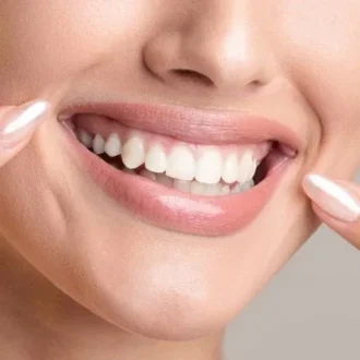 Laser Teeth Whitening Cost in Islamabad