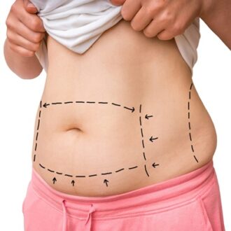 Tummy Tuck Cost in Islamabad