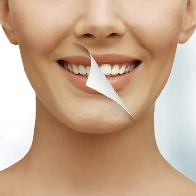 Can Laser Teeth Whitening remove stains permanently?