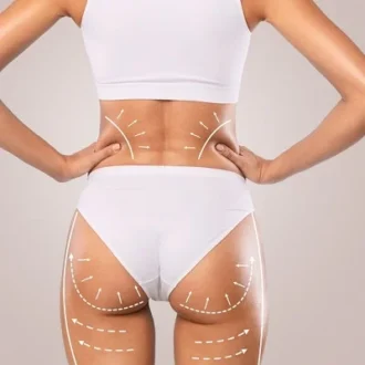 Brazilian Butt Lift Cost in Islamabad