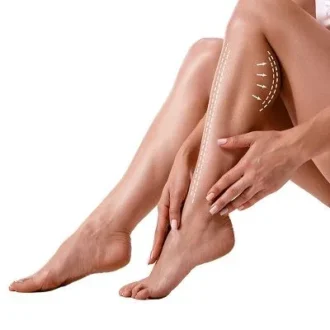 Calf Reduction Cost in Islamabad