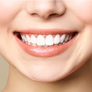 Is Laser Treatment safe for Teeth?