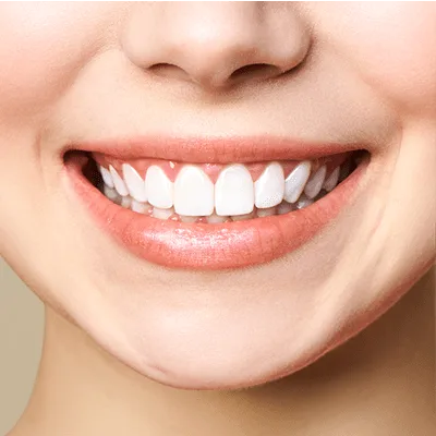 Is Laser Treatment safe for Teeth?
