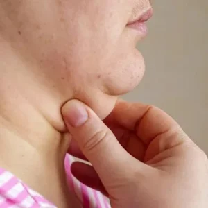 Double Chin Removal Cost in Islamabad
