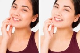 result of glutathione injections results