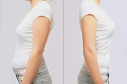 weight loss before and after