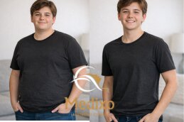 Before and after boy result ozempic injection