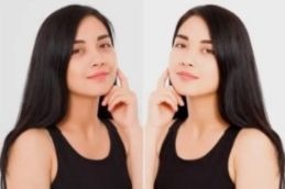 Jawline Before and After Result