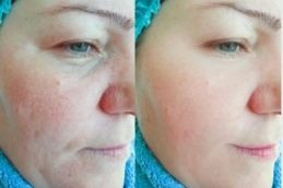 Chemical before and after