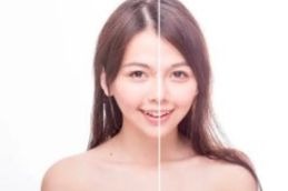 Before and after result
