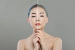 before and after result of gluta thione injection