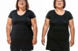 Before and After zepbound injection