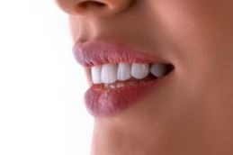 Teeth whitening after result