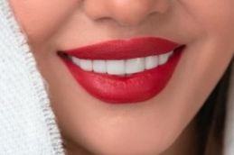 before and after teeth whitening procedure