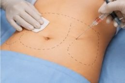 Step 1 of 360 Liposuction in Islamabad