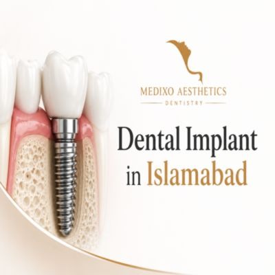 Dental Implants in Islamabad