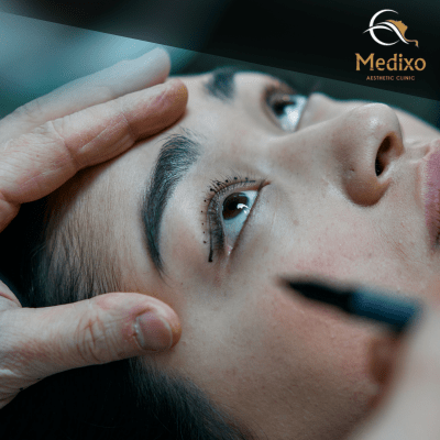 Eyelid Surgery in Islamabad, Rawalpindi, Pakistan – Before and After Blepharoplasty Results