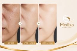 glutathione injection before after results skin whitening and glutathione whitening injection Skin whitening Glutathione injections drips Glutathione Injections Islamabad Pakistan |