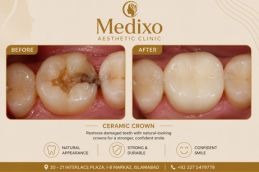 Ceramic Crown Islamabad
