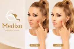 before and after skin whitening in islamabad and rawalpindi