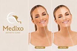 before and after skin whitening